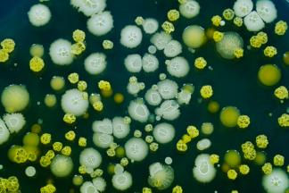 colonies of bacteria